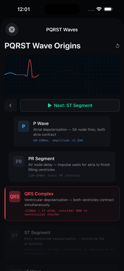 CardioLens — PQRST Wave Origins