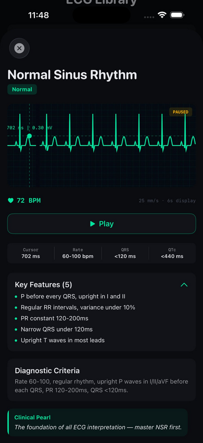 CardioLens — ECG Library
