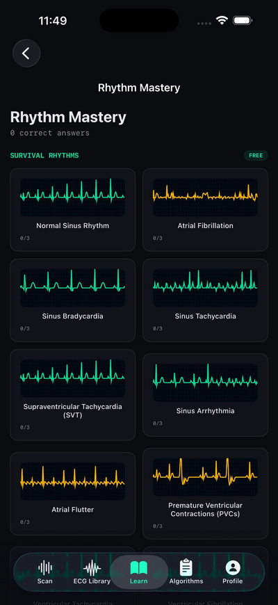 CardioLens — Rhythm Mastery